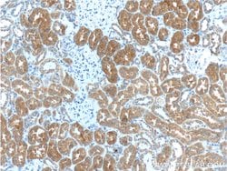 IkB alpha Rabbit anti-Human, Polyclonal, Proteintech 150 &mu;L; Unconjugated:Antibodies,