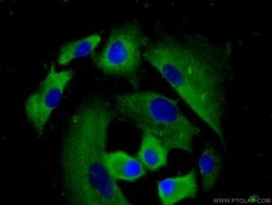 MMP28 Rabbit anti-Human, Mouse, Rat, Polyclonal, Proteintech