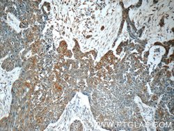 MMP28 Rabbit anti-Human, Mouse, Rat, Polyclonal, Proteintech 150 &mu;L;
