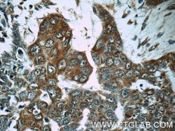 MMP28 Rabbit anti-Human, Mouse, Rat, Polyclonal, Proteintech 150 &mu;L;