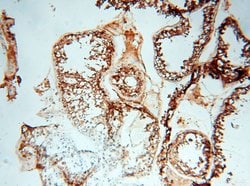 MMP28 Rabbit anti-Human, Mouse, Rat, Polyclonal, Proteintech 150 &mu;L;