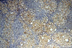 MMP28 Rabbit anti-Human, Mouse, Rat, Polyclonal, Proteintech 150 &mu;L;