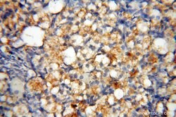 MMP28 Rabbit anti-Human, Mouse, Rat, Polyclonal, Proteintech 150 &mu;L;