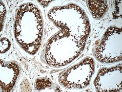 MMP28 Rabbit anti-Human, Mouse, Rat, Polyclonal, Proteintech 150 &mu;L;