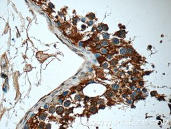 MMP28 Rabbit anti-Human, Mouse, Rat, Polyclonal, Proteintech 150 &mu;L;