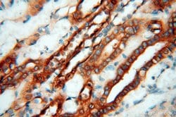 MMP28 Rabbit anti-Human, Mouse, Rat, Polyclonal, Proteintech 150 &mu;L;