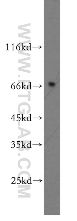 MMP28 Rabbit anti-Human, Mouse, Rat, Polyclonal, Proteintech 150 &mu;L;