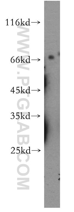 MMP28 Rabbit anti-Human, Mouse, Rat, Polyclonal, Proteintech 150 &mu;L;