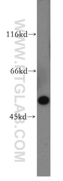 MMP28 Rabbit anti-Human, Mouse, Rat, Polyclonal, Proteintech 150 &mu;L;