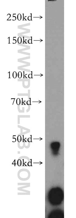GADL1 Rabbit anti-Human, Mouse, Rat, Polyclonal, Proteintech 150 &mu;L;