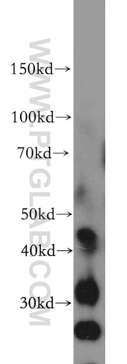 GADL1 Rabbit anti-Human, Mouse, Rat, Polyclonal, Proteintech 150 &mu;L;
