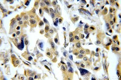 CHST3 Rabbit anti-Human, Mouse, Rat, Polyclonal, Proteintech 150 &mu;L;