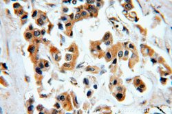 CHST3 Rabbit anti-Human, Mouse, Rat, Polyclonal, Proteintech 150 &mu;L;