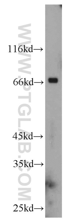 CHST3 Rabbit anti-Human, Mouse, Rat, Polyclonal, Proteintech 150 &mu;L;