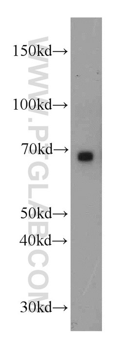 CHST3 Rabbit anti-Human, Mouse, Rat, Polyclonal, Proteintech 150 &mu;L;