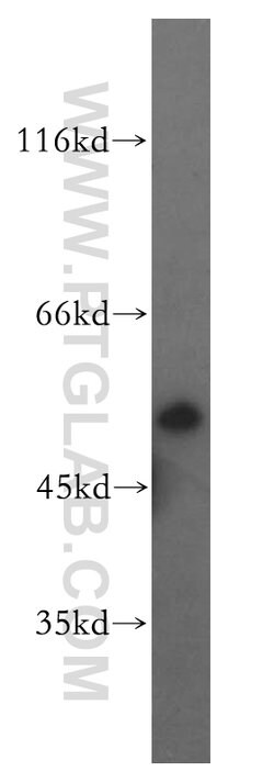 GSR Rabbit anti-Human, Mouse, Rat, Polyclonal, Proteintech 150 &mu;L; Unconjugated 