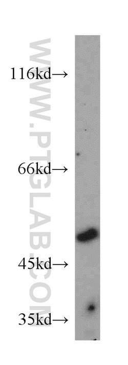 CHN2 Rabbit anti-Human, Mouse, Polyclonal, Proteintech 20 &mu;L; Unconjugated:Anticuerpos