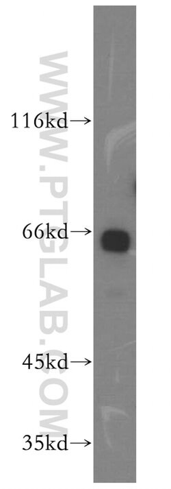 GAS8 Rabbit anti-Human, Mouse, Rat, Polyclonal, Proteintech:Antibodies:Primary
