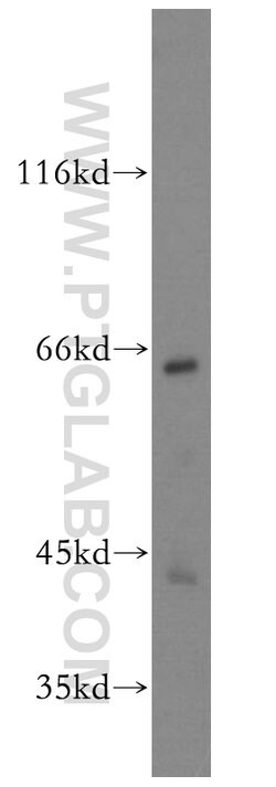 GAS8 Rabbit anti-Human, Mouse, Rat, Polyclonal, Proteintech:Antibodies:Primary