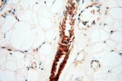 STRAP Rabbit anti-Human, Mouse, Rat, Polyclonal, Proteintech:Anticuerpos:Anticuerpos