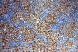 STRAP Rabbit anti-Human, Mouse, Rat, Polyclonal, Proteintech:Anticuerpos:Anticuerpos