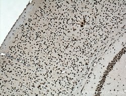 TDP-43 Rabbit anti-Human, Mouse, Rat, Polyclonal, Proteintech:Antibodies:Primary
