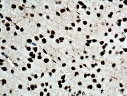 TDP-43 Rabbit anti-Human, Mouse, Rat, Polyclonal, Proteintech:Antibodies:Primary