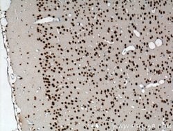 TDP-43 Rabbit anti-Human, Mouse, Rat, Polyclonal, Proteintech:Antibodies:Primary
