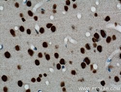 Proteintech TDP-43 Rabbit anti-Human, Mouse, Rat, Polyclonal, Proteintech