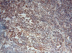 TDP-43 Rabbit anti-Human, Mouse, Rat, Polyclonal, Proteintech:Antibodies:Primary