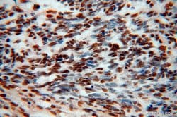 TDP-43 Rabbit anti-Human, Mouse, Rat, Polyclonal, Proteintech:Antibodies:Primary