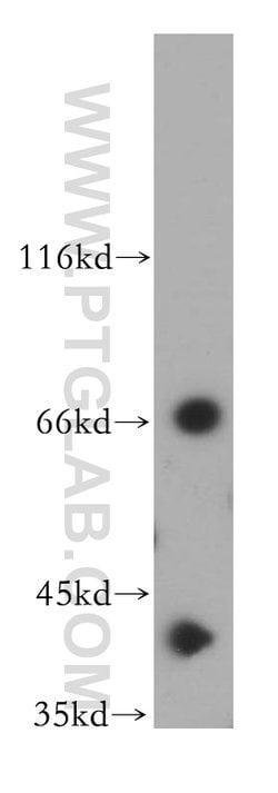 TDP-43 Rabbit anti-Human, Mouse, Rat, Polyclonal, Proteintech:Antibodies:Primary