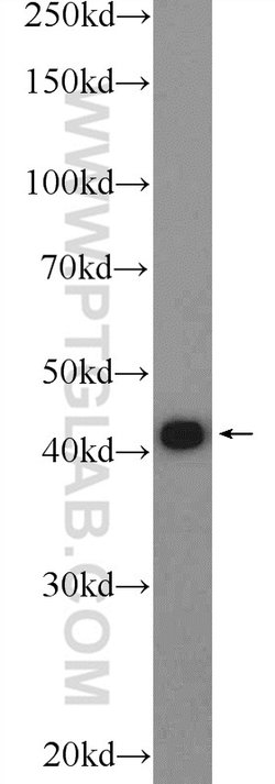 TDP-43 Rabbit anti-Human, Mouse, Rat, Polyclonal, Proteintech:Antibodies:Primary