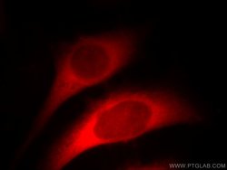 HSP27 Rabbit anti-Human, Mouse, Rat, Polyclonal, Proteintech 150 &mu;L | Buy Online | Proteintech Group Inc | Fisher Scientific