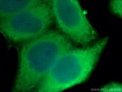 HSP27 Rabbit anti-Human, Mouse, Rat, Polyclonal, Proteintech 150 &mu;L | Buy Online | Proteintech Group Inc | Fisher Scientific