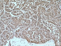 HSP27 Rabbit anti-Human, Mouse, Rat, Polyclonal, Proteintech 150 &mu;L | Buy Online | Proteintech Group Inc | Fisher Scientific