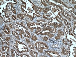 HSP27 Rabbit anti-Human, Mouse, Rat, Polyclonal, Proteintech 150 &mu;L | Buy Online | Proteintech Group Inc | Fisher Scientific