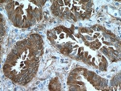 HSP27 Rabbit anti-Human, Mouse, Rat, Polyclonal, Proteintech 150 &mu;L | Buy Online | Proteintech Group Inc | Fisher Scientific