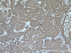 HSP27 Rabbit anti-Human, Mouse, Rat, Polyclonal, Proteintech 150 &mu;L | Buy Online | Proteintech Group Inc | Fisher Scientific
