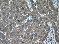 HSP27 Rabbit anti-Human, Mouse, Rat, Polyclonal, Proteintech 150 &mu;L | Buy Online | Proteintech Group Inc | Fisher Scientific