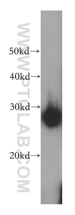HSP27 Rabbit anti-Human, Mouse, Rat, Polyclonal, Proteintech 150 &mu;L | Buy Online | Proteintech Group Inc | Fisher Scientific