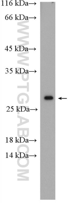 HSP27 Rabbit anti-Human, Mouse, Rat, Polyclonal, Proteintech 150 &mu;L | Buy Online | Proteintech Group Inc | Fisher Scientific