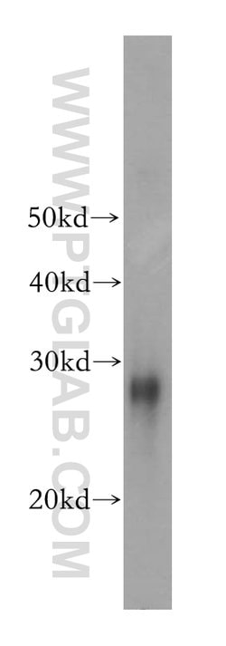 HSP27 Rabbit anti-Human, Mouse, Rat, Polyclonal, Proteintech 150 &mu;L | Buy Online | Proteintech Group Inc | Fisher Scientific