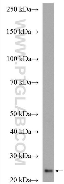 HSP27 Rabbit anti-Human, Mouse, Rat, Polyclonal, Proteintech 150 &mu;L | Buy Online | Proteintech Group Inc | Fisher Scientific