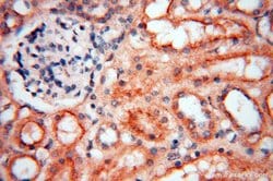 MEF2C Rabbit anti-Human, Mouse, Rat, Polyclonal, Proteintech:Antibodies:Primary