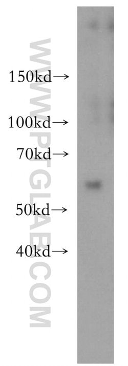 MEF2C Rabbit anti-Human, Mouse, Rat, Polyclonal, Proteintech:Antibodies:Primary