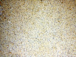 Endostatin Rabbit anti-Human, Polyclonal, Proteintech 150 μL; Unconjugated:Antibodies,
