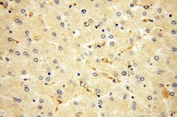 Endostatin Rabbit anti-Human, Polyclonal, Proteintech 150 μL; Unconjugated:Antibodies,