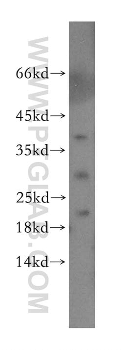 Endostatin Rabbit anti-Human, Polyclonal, Proteintech 150 μL; Unconjugated:Antibodies,