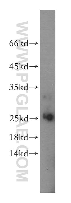 Endostatin Rabbit anti-Human, Polyclonal, Proteintech 150 μL; Unconjugated:Antibodies,